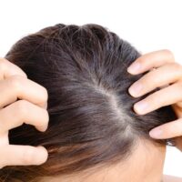Tipps gegen unreine Haut oder Kopfhaut